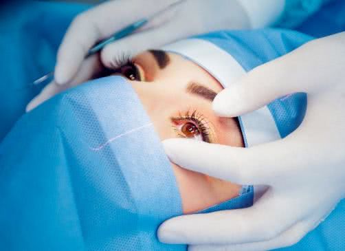 Lentes Intraoculares (Ambos Ojos) / Intravascular Lenses (Both Eyes)