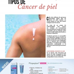  - mexico,skin news mayo / junio 2018